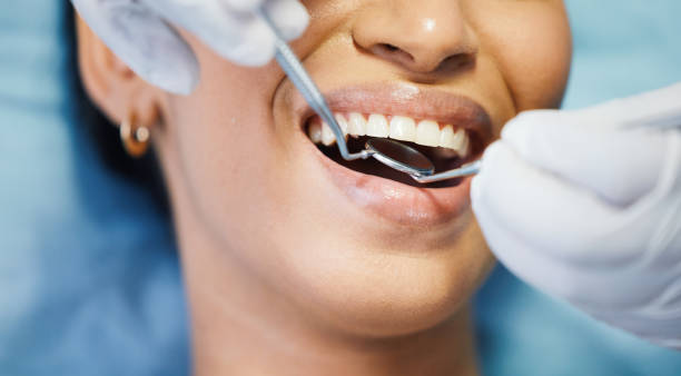 Best Emergency Dentist for Lost Fillings or Crowns in Sharon, WI